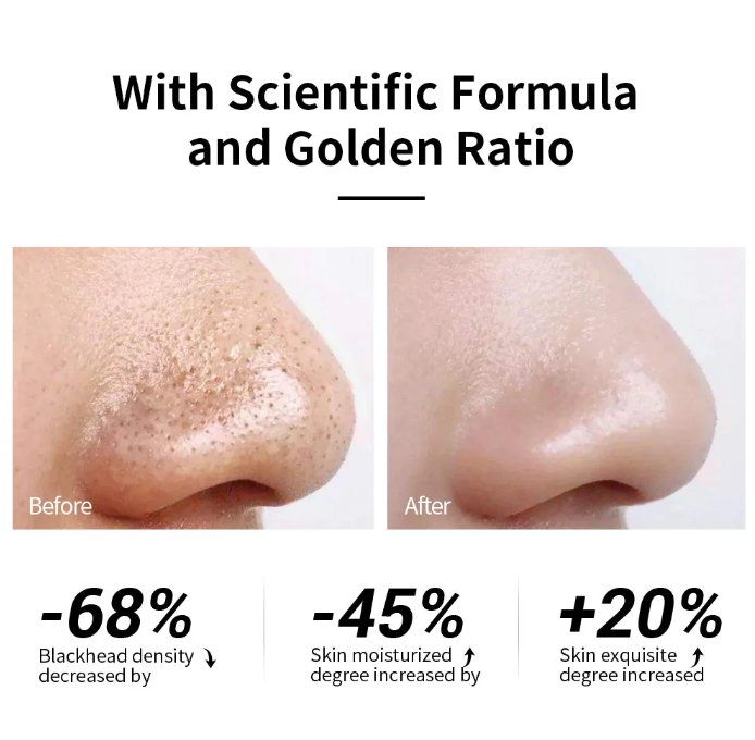 Labnena™ Pore Strips – Remove Blackheads in Just One Use